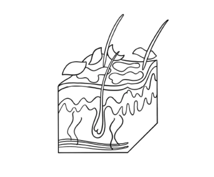 depigmentation cream causes