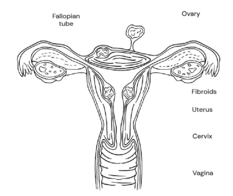 causes of heavy periods