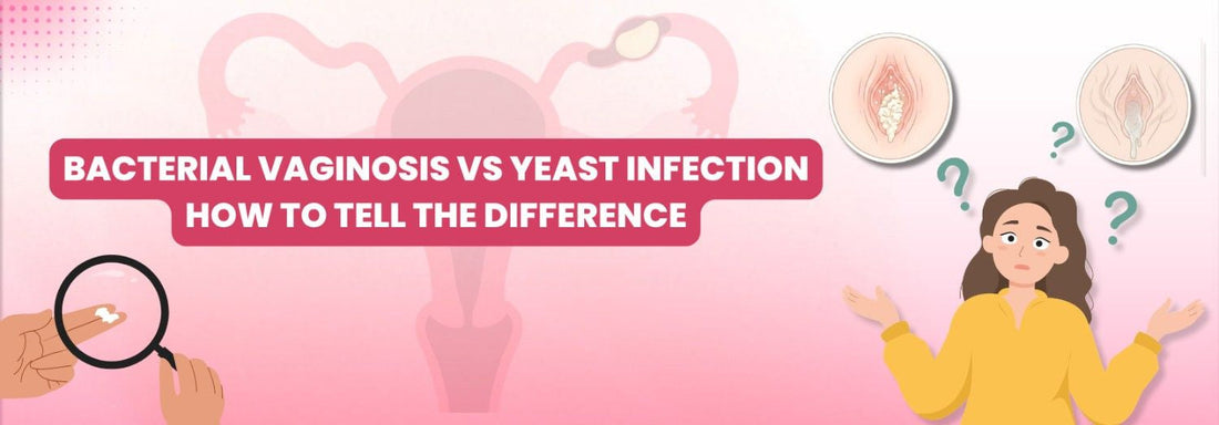 Bacterial Vaginosis vs Yeast Infection — How to Tell the Difference