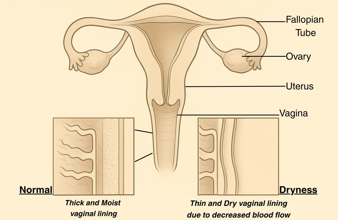 What causes vaginal discomfort during menopause?